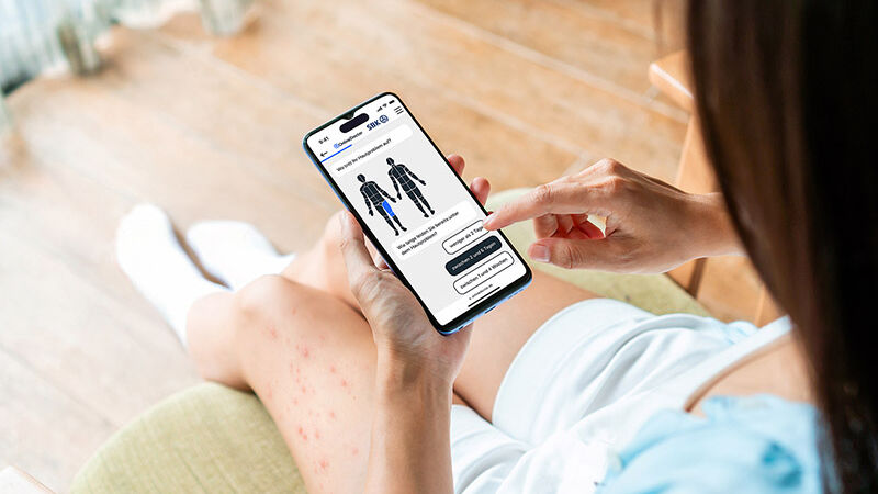 Frau mit Smartphone fotografiert Hautausschlag auf Oberschenkel