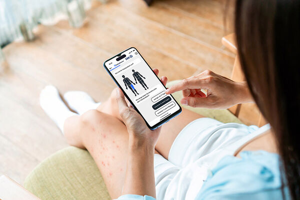 Frau mit Smartphone fotografiert Hautausschlag auf Oberschenkel